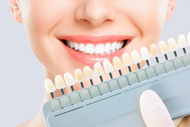 ホワイトニング